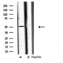 DF3896 staining 293 by IF/ICC. The sample were fixed with PFA and permeabilized in 0.1% Triton X-100,then blocked in 10% serum for 45 minutes at 25¡ãC. The primary antibody was diluted at 1/200 and incubated with the sample for 1 hour at 37¡ãC. An Alexa Fluor 594 conjugated goat anti-rabbit IgG (H+L) Ab, diluted at 1/600, was used as the secondary antibod