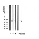DF3902 at 1/100 staining Mouse spleen tissue by IHC-P. The sample was formaldehyde fixed and a heat mediated antigen retrieval step in citrate buffer was performed. The sample was then blocked and incubated with the antibody for 1.5 hours at 22¡ãC. An HRP conjugated goat anti-rabbit antibody was used as the secondary