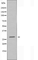 DF3908 staining Hela cells by IF/ICC. The sample were fixed with PFA and permeabilized in 0.1% Triton X-100,then blocked in 10% serum for 45 minutes at 25¡ãC. The primary antibody was diluted at 1/200 and incubated with the sample for 1 hour at 37¡ãC. An Alexa Fluor 594 conjugated goat anti-rabbit IgG (H+L) antibody(Cat.