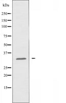 DF3912 at 1/100 staining Human Melanoma tissue by IHC-P. The sample was formaldehyde fixed and a heat mediated antigen retrieval step in citrate buffer was performed. The sample was then blocked and incubated with the antibody for 1.5 hours at 22¡ãC. An HRP conjugated goat anti-rabbit antibody was used as the secondary