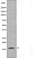 DF3914 staining HT29 cells by IF/ICC. The sample were fixed with PFA and permeabilized in 0.1% Triton X-100,then blocked in 10% serum for 45 minutes at 25¡ãC. The primary antibody was diluted at 1/200 and incubated with the sample for 1 hour at 37¡ãC. An Alexa Fluor 594 conjugated goat anti-rabbit IgG (H+L) antibody(Cat.