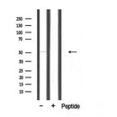 DF3919 staining COLO205 cells by IF/ICC. The sample were fixed with PFA and permeabilized in 0.1% Triton X-100,then blocked in 10% serum for 45 minutes at 25¡ãC. The primary antibody was diluted at 1/200 and incubated with the sample for 1 hour at 37¡ãC. An Alexa Fluor 594 conjugated goat anti-rabbit IgG (H+L) antibody(Cat.