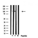 DF4015 staining LOVO cells by IF/ICC. The sample were fixed with PFA and permeabilized in 0.1% Triton X-100,then blocked in 10% serum for 45 minutes at 25¡ãC. The primary antibody was diluted at 1/200 and incubated with the sample for 1 hour at 37¡ãC. An Alexa Fluor 594 conjugated goat anti-rabbit IgG (H+L) antibody(Cat.