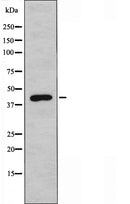 DF4394 staining HepG2 cells by IF/ICC. The sample were fixed with PFA and permeabilized in 0.1% Triton X-100,then blocked in 10% serum for 45 minutes at 25¡ãC. The primary antibody was diluted at 1/200 and incubated with the sample for 1 hour at 37¡ãC. An Alexa Fluor 594 conjugated goat anti-rabbit IgG (H+L) antibody(Cat.