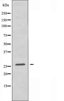 DF4411 staining Hela cells by IF/ICC. The sample were fixed with PFA and permeabilized in 0.1% Triton X-100,then blocked in 10% serum for 45 minutes at 25¡ãC. The primary antibody was diluted at 1/200 and incubated with the sample for 1 hour at 37¡ãC. An Alexa Fluor 594 conjugated goat anti-rabbit IgG (H+L) antibody(Cat.