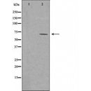 DF4418 staining Hela cells by IF/ICC. The sample were fixed with PFA and permeabilized in 0.1% Triton X-100,then blocked in 10% serum for 45 minutes at 25¡ãC. The primary antibody was diluted at 1/200 and incubated with the sample for 1 hour at 37¡ãC. An Alexa Fluor 594 conjugated goat anti-rabbit IgG (H+L) antibody(Cat.