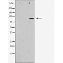 DF4428 staining LOVO cells by IF/ICC. The sample were fixed with PFA and permeabilized in 0.1% Triton X-100,then blocked in 10% serum for 45 minutes at 25¡ãC. The primary antibody was diluted at 1/200 and incubated with the sample for 1 hour at 37¡ãC. An Alexa Fluor 594 conjugated goat anti-rabbit IgG (H+L) antibody(Cat.