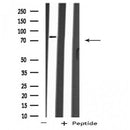 DF4433 staining A549 cells by IF/ICC. The sample were fixed with PFA and permeabilized in 0.1% Triton X-100,then blocked in 10% serum for 45 minutes at 25¡ãC. The primary antibody was diluted at 1/200 and incubated with the sample for 1 hour at 37¡ãC. An Alexa Fluor 594 conjugated goat anti-rabbit IgG (H+L) antibody(Cat.