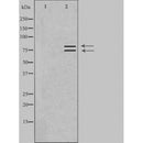 Western blot analysis of extracts from rat muscle cells using ARHGEF7 antibody.The lane on the left is treated with the antigen-specific peptide.
