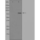 DF4443 staining HepG2 by IF/ICC. The sample were fixed with PFA and permeabilized in 0.1% Triton X-100,then blocked in 10% serum for 45 minutes at 25¡ãC. The primary antibody was diluted at 1/200 and incubated with the sample for 1 hour at 37¡ãC. An Alexa Fluor 594 conjugated goat anti-rabbit IgG (H+L) Ab, diluted at 1/600, was used as the secondary antibod