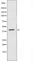 DF4444 staining MCF7 by IF/ICC. The sample were fixed with PFA and permeabilized in 0.1% Triton X-100,then blocked in 10% serum for 45 minutes at 25¡ãC. The primary antibody was diluted at 1/200 and incubated with the sample for 1 hour at 37¡ãC. An Alexa Fluor 594 conjugated goat anti-rabbit IgG (H+L) Ab, diluted at 1/600, was used as the secondary antibod