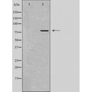 DF4448 staining HeLa cells by IF/ICC. The sample were fixed with PFA and permeabilized in 0.1% Triton X-100,then blocked in 10% serum for 45 minutes at 25¡ãC. The primary antibody was diluted at 1/200 and incubated with the sample for 1 hour at 37¡ãC. An Alexa Fluor 594 conjugated goat anti-rabbit IgG (H+L) antibody(Cat.