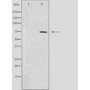 DF4450 staining A549 cells by IF/ICC. The sample were fixed with PFA and permeabilized in 0.1% Triton X-100,then blocked in 10% serum for 45 minutes at 25¡ãC. The primary antibody was diluted at 1/200 and incubated with the sample for 1 hour at 37¡ãC. An Alexa Fluor 594 conjugated goat anti-rabbit IgG (H+L) antibody(Cat.
