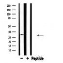DF4451 staining HeLa by IF/ICC. The sample were fixed with PFA and permeabilized in 0.1% Triton X-100,then blocked in 10% serum for 45 minutes at 25¡ãC. The primary antibody was diluted at 1/200 and incubated with the sample for 1 hour at 37¡ãC. An Alexa Fluor 594 conjugated goat anti-rabbit IgG (H+L) Ab, diluted at 1/600, was used as the secondary antibod