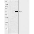 DF4470 staining HeLa cells by IF/ICC. The sample were fixed with PFA and permeabilized in 0.1% Triton X-100,then blocked in 10% serum for 45 minutes at 25¡ãC. The primary antibody was diluted at 1/200 and incubated with the sample for 1 hour at 37¡ãC. An Alexa Fluor 594 conjugated goat anti-rabbit IgG (H+L) antibody(Cat.