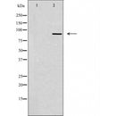 DF4478 staining COLO205 cells by IF/ICC. The sample were fixed with PFA and permeabilized in 0.1% Triton X-100,then blocked in 10% serum for 45 minutes at 25¡ãC. The primary antibody was diluted at 1/200 and incubated with the sample for 1 hour at 37¡ãC. An Alexa Fluor 594 conjugated goat anti-rabbit IgG (H+L) antibody(Cat.
