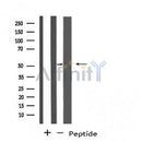 DF4487 staining COLO205 by IF/ICC. The sample were fixed with PFA and permeabilized in 0.1% Triton X-100,then blocked in 10% serum for 45 minutes at 25¡ãC. The primary antibody was diluted at 1/200 and incubated with the sample for 1 hour at 37¡ãC. An Alexa Fluor 594 conjugated goat anti-rabbit IgG (H+L) Ab, diluted at 1/600, was used as the secondary antibod