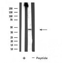 DF4489 staining HT29 by IF/ICC. The sample were fixed with PFA and permeabilized in 0.1% Triton X-100,then blocked in 10% serum for 45 minutes at 25¡ãC. The primary antibody was diluted at 1/200 and incubated with the sample for 1 hour at 37¡ãC. An Alexa Fluor 594 conjugated goat anti-rabbit IgG (H+L) Ab, diluted at 1/600, was used as the secondary antibod