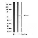 DF4506 staining Hela cells by IF/ICC. The sample were fixed with PFA and permeabilized in 0.1% Triton X-100,then blocked in 10% serum for 45 minutes at 25¡ãC. The primary antibody was diluted at 1/200 and incubated with the sample for 1 hour at 37¡ãC. An Alexa Fluor 594 conjugated goat anti-rabbit IgG (H+L) antibody(Cat.