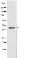DF4508 staining Hela by IF/ICC. The sample were fixed with PFA and permeabilized in 0.1% Triton X-100,then blocked in 10% serum for 45 minutes at 25¡ãC. The primary antibody was diluted at 1/200 and incubated with the sample for 1 hour at 37¡ãC. An Alexa Fluor 594 conjugated goat anti-rabbit IgG (H+L) Ab, diluted at 1/600, was used as the secondary antibod