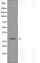 DF4512 staining HepG2 by IF/ICC. The sample were fixed with PFA and permeabilized in 0.1% Triton X-100,then blocked in 10% serum for 45 minutes at 25¡ãC. The primary antibody was diluted at 1/200 and incubated with the sample for 1 hour at 37¡ãC. An Alexa Fluor 594 conjugated goat anti-rabbit IgG (H+L) Ab, diluted at 1/600, was used as the secondary antibod