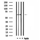 DF4519 staining Hela by IF/ICC. The sample were fixed with PFA and permeabilized in 0.1% Triton X-100,then blocked in 10% serum for 45 minutes at 25¡ãC. The primary antibody was diluted at 1/200 and incubated with the sample for 1 hour at 37¡ãC. An Alexa Fluor 594 conjugated goat anti-rabbit IgG (H+L) Ab, diluted at 1/600, was used as the secondary antibod