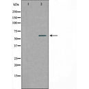 DF4525 staining RAW264.7 by IF/ICC. The sample were fixed with PFA and permeabilized in 0.1% Triton X-100,then blocked in 10% serum for 45 minutes at 25¡ãC. The primary antibody was diluted at 1/200 and incubated with the sample for 1 hour at 37¡ãC. An Alexa Fluor 594 conjugated goat anti-rabbit IgG (H+L) Ab, diluted at 1/600, was used as the secondary antibod