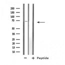 Western blot analysis of extracts from Rat brain lysate, using SLC6A3 antibody.