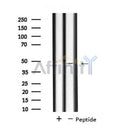 DF4531 staining HepG2 by IF/ICC. The sample were fixed with PFA and permeabilized in 0.1% Triton X-100,then blocked in 10% serum for 45 minutes at 25¡ãC. The primary antibody was diluted at 1/200 and incubated with the sample for 1 hour at 37¡ãC. An Alexa Fluor 594 conjugated goat anti-rabbit IgG (H+L) Ab, diluted at 1/600, was used as the secondary antibod