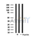 DF4552 staining CoLo205 cells by IF/ICC. The sample were fixed with PFA and permeabilized in 0.1% Triton X-100,then blocked in 10% serum for 45 minutes at 25¡ãC. The primary antibody was diluted at 1/200 and incubated with the sample for 1 hour at 37¡ãC. An Alexa Fluor 594 conjugated goat anti-rabbit IgG (H+L) antibody(Cat.