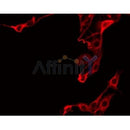 Western blot analysis of extracts from rat heart, using ZADH1 Antibody. Lane 1 was treated with the blocking peptide.