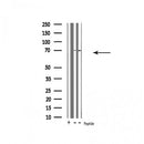 DF4585 at 1/100 staining Rat lung tissue by IHC-P. The sample was formaldehyde fixed and a heat mediated antigen retrieval step in citrate buffer was performed. The sample was then blocked and incubated with the antibody for 1.5 hours at 22¡ãC. An HRP conjugated goat anti-rabbit antibody was used as the secondary