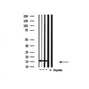 DF4600 staining HeLa cells by IF/ICC. The sample were fixed with PFA and permeabilized in 0.1% Triton X-100,then blocked in 10% serum for 45 minutes at 25¡ãC. The primary antibody was diluted at 1/200 and incubated with the sample for 1 hour at 37¡ãC. An Alexa Fluor 594 conjugated goat anti-rabbit IgG (H+L) antibody(Cat.