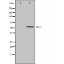 DF4602 at 1/100 staining Human Melanoma tissue by IHC-P. The sample was formaldehyde fixed and a heat mediated antigen retrieval step in citrate buffer was performed. The sample was then blocked and incubated with the antibody for 1.5 hours at 22¡ãC. An HRP conjugated goat anti-rabbit antibody was used as the secondary