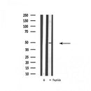 Western blot analysis of extracts from various samples, using ATP6V1C2 Antibody.
Lane 1: 293 treated with blocking peptide.
Lane 2: 293;
Lane 3: Hela;