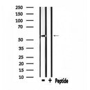 DF4621 staining HepG2 by IF/ICC. The sample were fixed with PFA and permeabilized in 0.1% Triton X-100,then blocked in 10% serum for 45 minutes at 25¡ãC. The primary antibody was diluted at 1/200 and incubated with the sample for 1 hour at 37¡ãC. An Alexa Fluor 594 conjugated goat anti-rabbit IgG (H+L) Ab, diluted at 1/600, was used as the secondary antibod