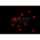 Western blot analysis of extracts from Hela, using ZC3H13 Antibody. Lane 1 was treated with the blocking peptide.