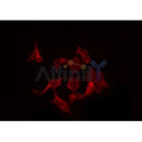 DF4632 staining Hela by IF/ICC. The samples were fixed with PFA and permeabilized in 0.1% Triton X-100,then blocked in 10% serum for 45 minutes at 25¡ãC. Samples were then incubated with primary Ab(DF4632 1:200) and mouse anti-beta tubulin Ab(T0023 1:200) for 1 hour at 37¡ãC. An AlexaFluor594 conjugated goat anti-rabbit IgG(H+L) Ab(S0006 Red 1:600) and an AlexaFluor488 conjugated goat anti-mouse IgG(H+L) Ab(S0017 Green 1:600) were used as the secondary antibod