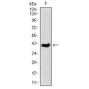 DF4653 staining HepG2 cells by IF/ICC. The sample were fixed with PFA and permeabilized in 0.1% Triton X-100,then blocked in 10% serum for 45 minutes at 25¡ãC. The primary antibody was diluted at 1/200 and incubated with the sample for 1 hour at 37¡ãC. An Alexa Fluor 594 conjugated goat anti-rabbit IgG (H+L) antibody(Cat.