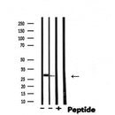 DF4664 staining LOVO cells by IF/ICC. The sample were fixed with PFA and permeabilized in 0.1% Triton X-100,then blocked in 10% serum for 45 minutes at 25¡ãC. The primary antibody was diluted at 1/200 and incubated with the sample for 1 hour at 37¡ãC. An Alexa Fluor 594 conjugated goat anti-rabbit IgG (H+L) antibody(Cat.