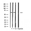 DF4668 staining HepG2 by IF/ICC. The sample were fixed with PFA and permeabilized in 0.1% Triton X-100,then blocked in 10% serum for 45 minutes at 25¡ãC. The primary antibody was diluted at 1/200 and incubated with the sample for 1 hour at 37¡ãC. An Alexa Fluor 594 conjugated goat anti-rabbit IgG (H+L) Ab, diluted at 1/600, was used as the secondary antibod