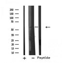 DF4695 staining COLO205 by IF/ICC. The sample were fixed with PFA and permeabilized in 0.1% Triton X-100,then blocked in 10% serum for 45 minutes at 25¡ãC. The primary antibody was diluted at 1/200 and incubated with the sample for 1 hour at 37¡ãC. An Alexa Fluor 594 conjugated goat anti-rabbit IgG (H+L) Ab, diluted at 1/600, was used as the secondary antibod