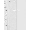 DF4704 staining HuvEC/ cells by IF/ICC. The sample were fixed with PFA and permeabilized in 0.1% Triton X-100,then blocked in 10% serum for 45 minutes at 25¡ãC. The primary antibody was diluted at 1/200 and incubated with the sample for 1 hour at 37¡ãC. An Alexa Fluor 594 conjugated goat anti-rabbit IgG (H+L) antibody(Cat.