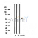 Western blot analysis of extracts from rat brain, using IL11RA Antibody. Lane 1 was treated with the antigen-specific peptide.