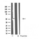 DF4711 staining Hela cells by IF/ICC. The sample were fixed with PFA and permeabilized in 0.1% Triton X-100,then blocked in 10% serum for 45 minutes at 25¡ãC. The primary antibody was diluted at 1/200 and incubated with the sample for 1 hour at 37¡ãC. An Alexa Fluor 594 conjugated goat anti-rabbit IgG (H+L) antibody(Cat.