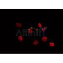 Western blot analysis of extracts from HepG2, using SUV39H2 Antibody. Lane 1 was treated with the antigen-specific peptide.