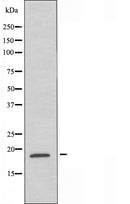DF4730 staining Hela cells by IF/ICC. The sample were fixed with PFA and permeabilized in 0.1% Triton X-100,then blocked in 10% serum for 45 minutes at 25¡ãC. The primary antibody was diluted at 1/200 and incubated with the sample for 1 hour at 37¡ãC. An Alexa Fluor 594 conjugated goat anti-rabbit IgG (H+L) antibody(Cat.