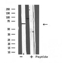 DF4732 staining HeLa cells by IF/ICC. The sample were fixed with PFA and permeabilized in 0.1% Triton X-100,then blocked in 10% serum for 45 minutes at 25¡ãC. The primary antibody was diluted at 1/200 and incubated with the sample for 1 hour at 37¡ãC. An Alexa Fluor 594 conjugated goat anti-rabbit IgG (H+L) antibody(Cat.
