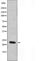 DF4737 staining HuvEc by IF/ICC. The sample were fixed with PFA and permeabilized in 0.1% Triton X-100,then blocked in 10% serum for 45 minutes at 25¡ãC. The primary antibody was diluted at 1/200 and incubated with the sample for 1 hour at 37¡ãC. An Alexa Fluor 594 conjugated goat anti-rabbit IgG (H+L) Ab, diluted at 1/600, was used as the secondary antibod