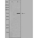 DF4738 staining HepG2 by IF/ICC. The sample were fixed with PFA and permeabilized in 0.1% Triton X-100,then blocked in 10% serum for 45 minutes at 25¡ãC. The primary antibody was diluted at 1/200 and incubated with the sample for 1 hour at 37¡ãC. An Alexa Fluor 594 conjugated goat anti-rabbit IgG (H+L) Ab, diluted at 1/600, was used as the secondary antibod
